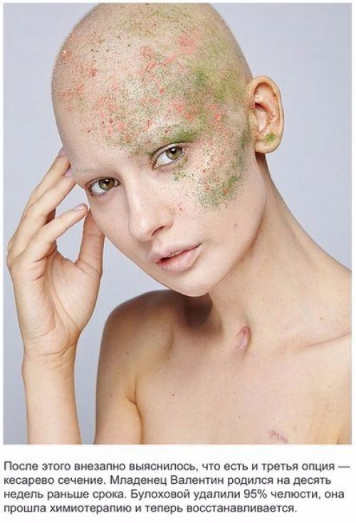 Здравствуйте.  Что можно использовать вместо специальной емкости для дезинфецирующего раствора? 07