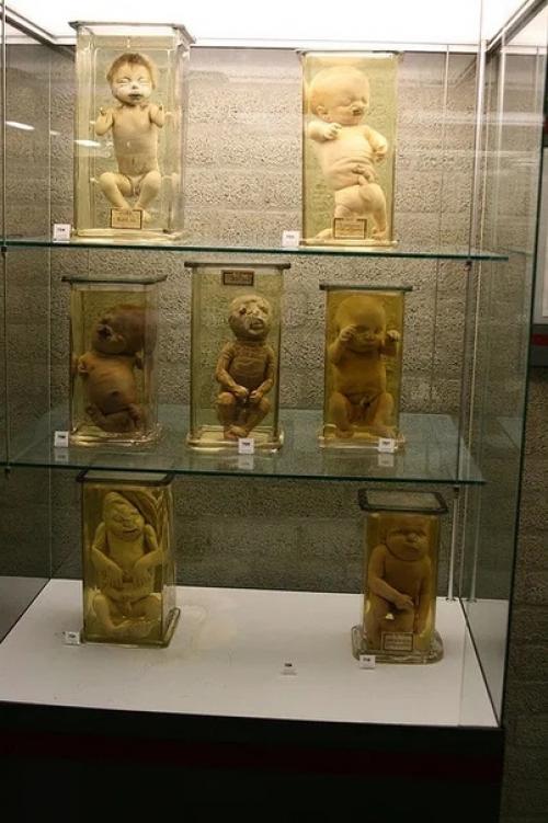 В амстердамском университете анатомии и эмбриологии имени гарардаса вролика хранится самая большая в мире коллекция человеческих мутаций. 03