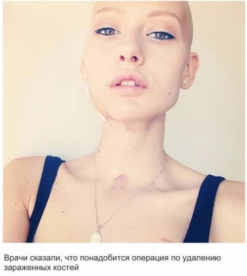 Здравствуйте.  Что можно использовать вместо специальной емкости для дезинфецирующего раствора? 01