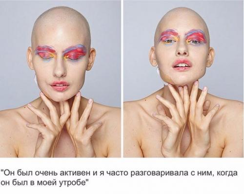 Здравствуйте.  Что можно использовать вместо специальной емкости для дезинфецирующего раствора? 04