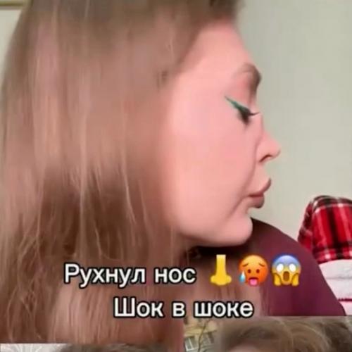 Москвичка столкнулась с серьёзными проблемами из-за привычки часто ковырять в носу. 

