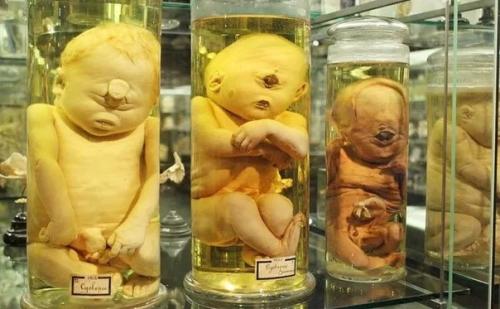 В амстердамском университете анатомии и эмбриологии имени гарардаса вролика хранится самая большая в мире коллекция человеческих мутаций. 01