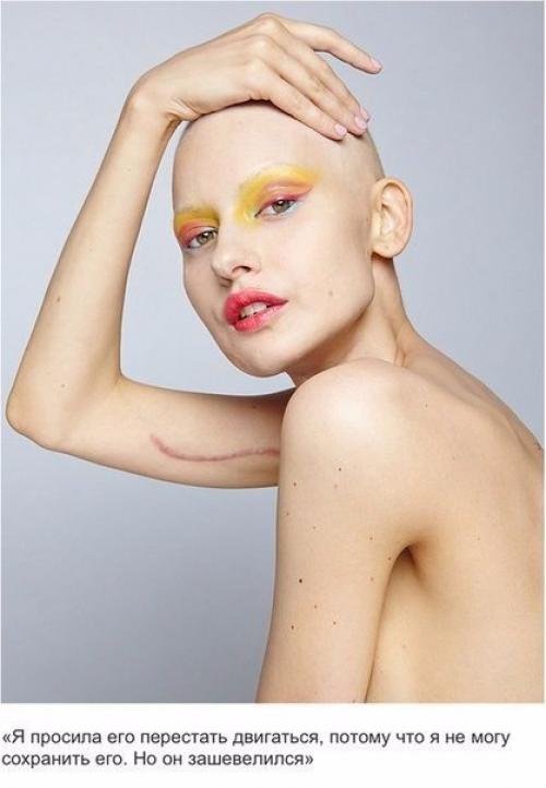 Здравствуйте.  Что можно использовать вместо специальной емкости для дезинфецирующего раствора? 05