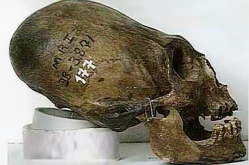 Откуда берутся удлинённые черепа? 01