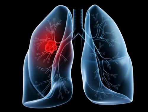 Легкие - единственные органы, которые могут плавать на воде. 01