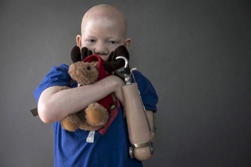 Альбиносов на куски ради ритуалов и обрядов шаманов рвут. 04