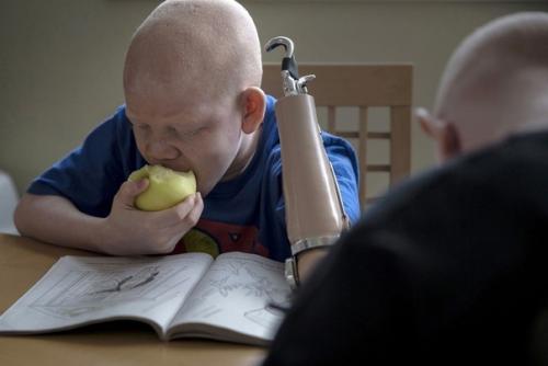 Альбиносов на куски ради ритуалов и обрядов шаманов рвут. 01