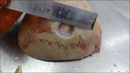 Дырки в человеческих головах: зачем их сверлили 11 тысяч лет назад? 07 Дырки в человеческих головах: зачем их сверлили 11 тысяч лет назад? 07