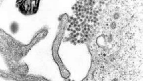 Неизвестный ранее человеческий вирус обнаружили в старых образцах крови.
