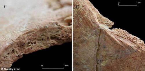 Дырки в человеческих головах: зачем их сверлили 11 тысяч лет назад? 05 Дырки в человеческих головах: зачем их сверлили 11 тысяч лет назад? 05