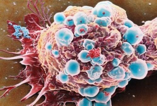 Ученые установили, каким образом раковые клетки образуют опухоли.