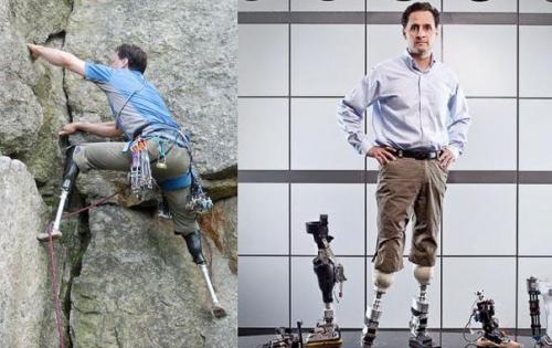 Cамый совершенный протез в мире.