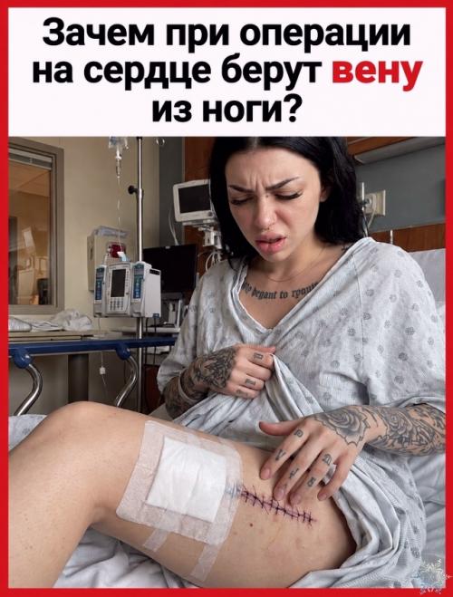Зачем при операции на сердце берут вену из ноги? 

