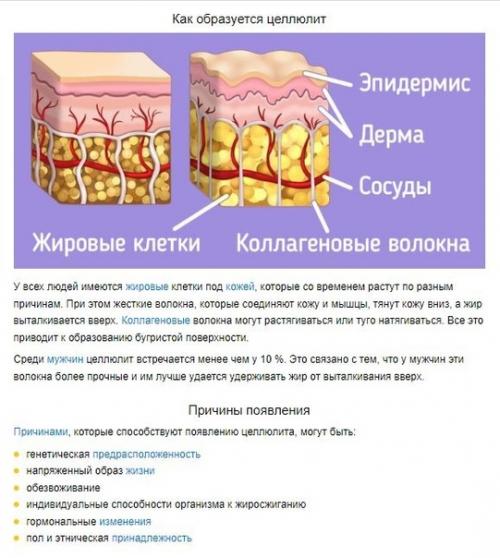Что такое целлюлит и как он образуется. 01