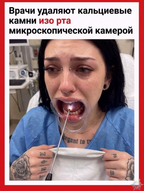 Откуда под языком может взяться настоящий камень? 02