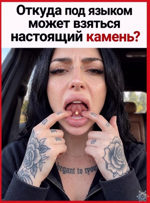 Откуда под языком может взяться настоящий камень? 

