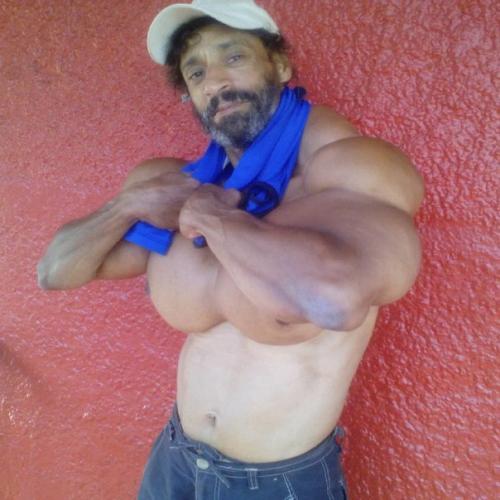 Бодибилдер сделал инъекции масла в свои мускулы - и взгляните, что из этого вышло. 04