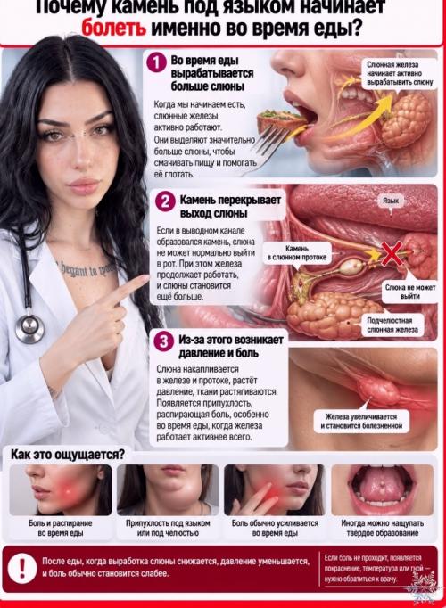 Откуда под языком может взяться настоящий камень? 07
