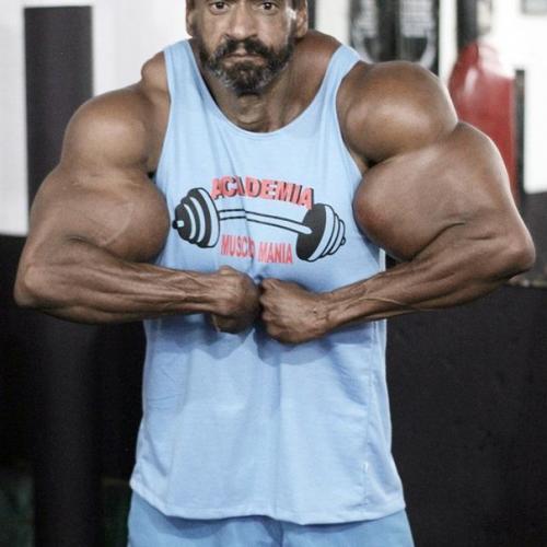 Бодибилдер сделал инъекции масла в свои мускулы - и взгляните, что из этого вышло. 02