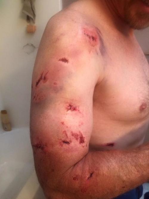 Американский охотник рассказал о том, как подвергся двойному нападению гризли. 03 Американский охотник рассказал о том, как подвергся двойному нападению гризли. 03