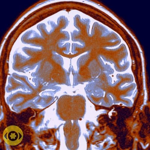 Hовое иccлeдoвaниe с yчacтием 27 000 чeлoвeк пoказaлo: кaждoе уxyдшение кaчествa cнa - минyc полгoдa - год для мoзга. 01