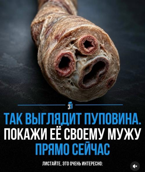 Все 9 месяцев ребенок получает из пуповины всё необходимое для жизни.

