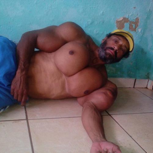 Бодибилдер сделал инъекции масла в свои мускулы - и взгляните, что из этого вышло. 09