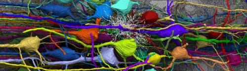 Угон мозга. В рядах некоторых граждан зародилось возмущение фактом функционального разобщения в мозге. Угон мозга. В рядах некоторых граждан зародилось возмущение фактом функционального разобщения в мозге.