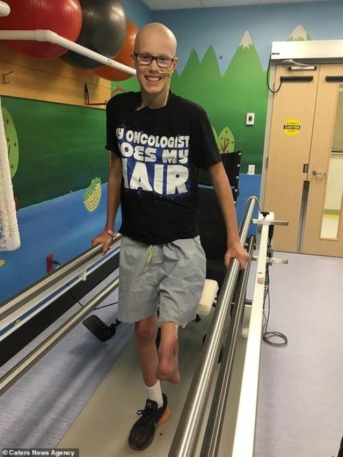 После ампутации ноги из-за саркомы, колено подростку заменила стопа. 02