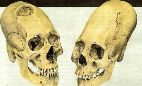 Голова за трон. Голова за трон.