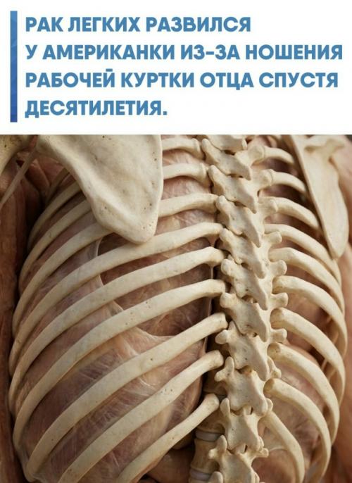 В 36 лет у женщины диагностировали тяжелое заболевание, хотя она никогда не курила и не работала на опасном производстве.  