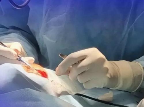 Девочка ослепла на один глаз после выстрела светошумовым патроном в приморье.

