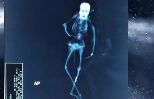 Рентгеновский снимок странного существа с крыльями опубликован. 06