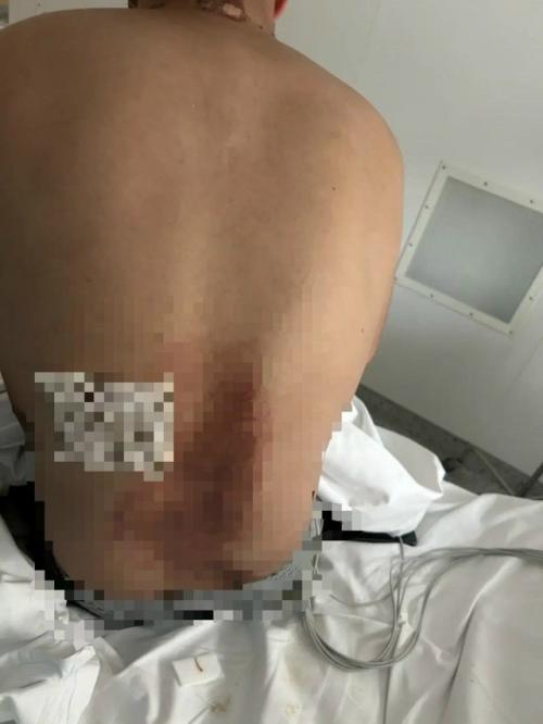 В участника сво ударила молния, когда он был на лошади. 02 В участника сво ударила молния, когда он был на лошади. 02