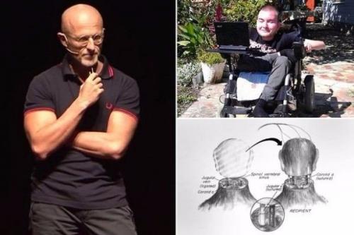 Хирурги о готовности к пересадке головы сообщили.