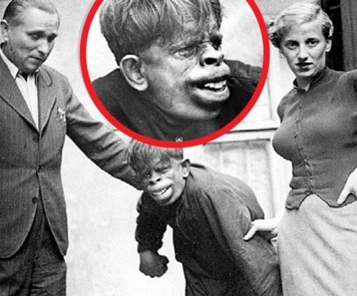 Вот откуда мода пошла на утиные губы. 02