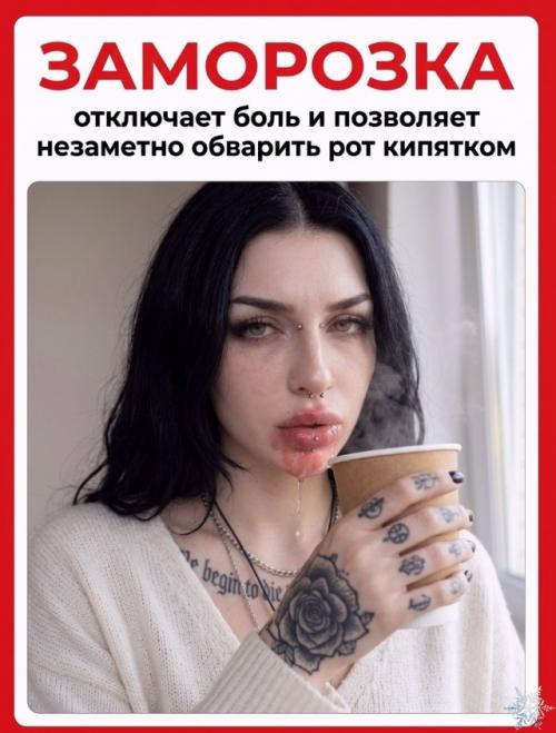 Почему после укола у стоматолога губа кажется огромной, хотя не распухла? 02 Почему после укола у стоматолога губа кажется огромной, хотя не распухла? 02