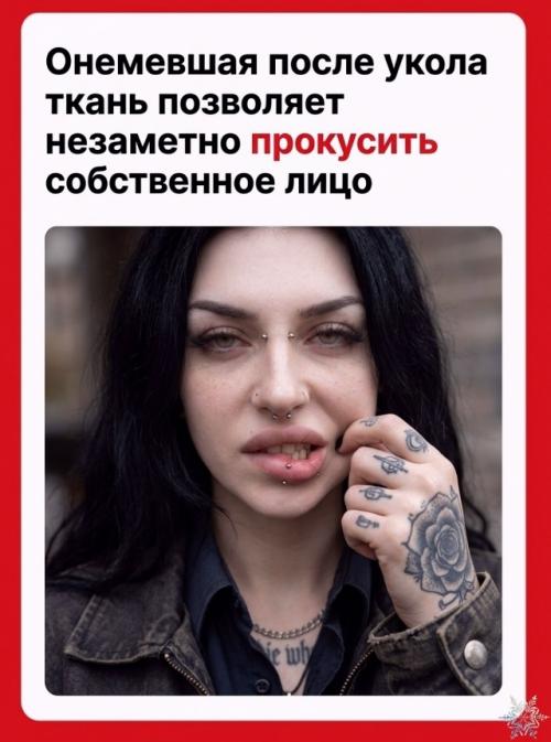 Почему после укола у стоматолога губа кажется огромной, хотя не распухла? 

