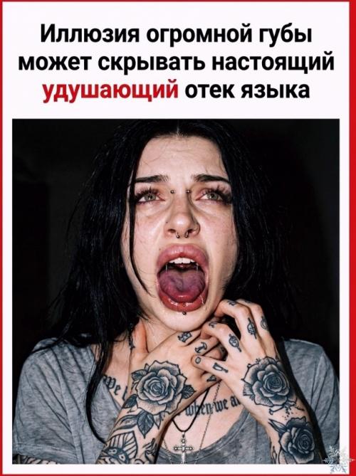 Почему после укола у стоматолога губа кажется огромной, хотя не распухла? 01 Почему после укола у стоматолога губа кажется огромной, хотя не распухла? 01