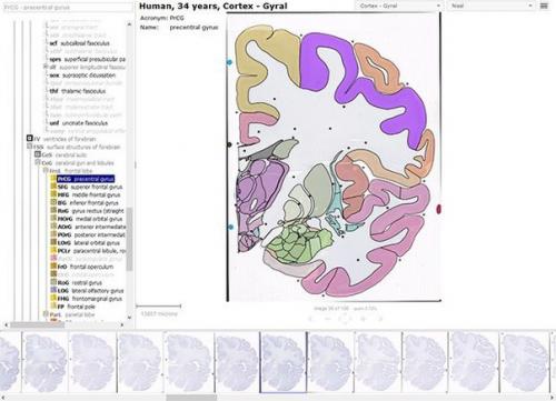 Атлас мозга с микронным разрешением появился в открытом доступе.