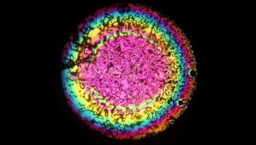 Имплантируемые жидкокристаллические линзы от очков избавят.