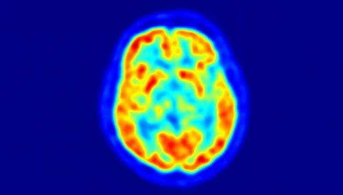Впервые найдены группы генов, управляющие интеллектом человека.
