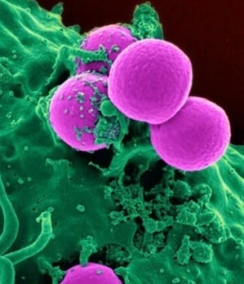 Доктор юман фонг создал вирус, который убивает раковые клетки любого типа. 01