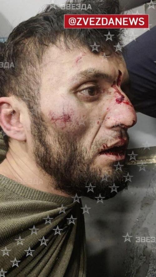 Появились кадры террористов и автобиля, на котором они пытались скрыться. 03