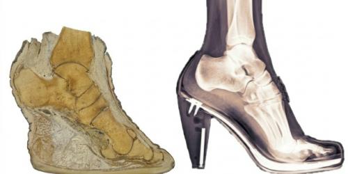 Ученые показали, как устроена нога слона в разрезе. 02