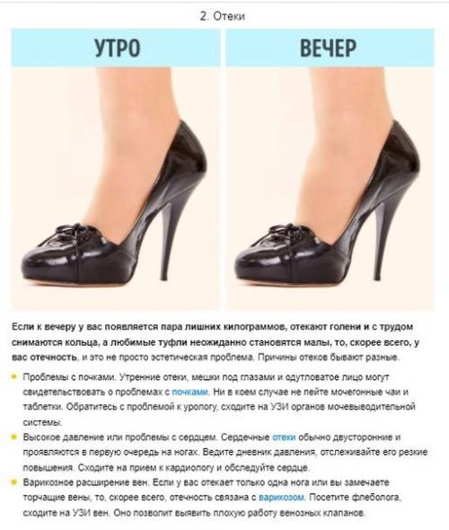 7 сигналов организма, которые не стоит игнорировать, чтобы сохранить здоровье. 05