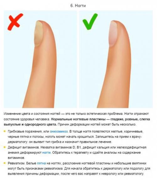 7 сигналов организма, которые не стоит игнорировать, чтобы сохранить здоровье. 01