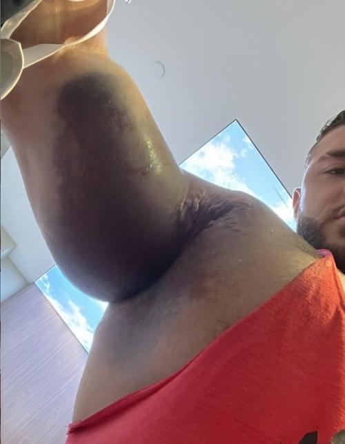 Когда штанга касается груди, волокна большой грудной мышцы находятся в фазе максимального эксцентрического растяжения. 01