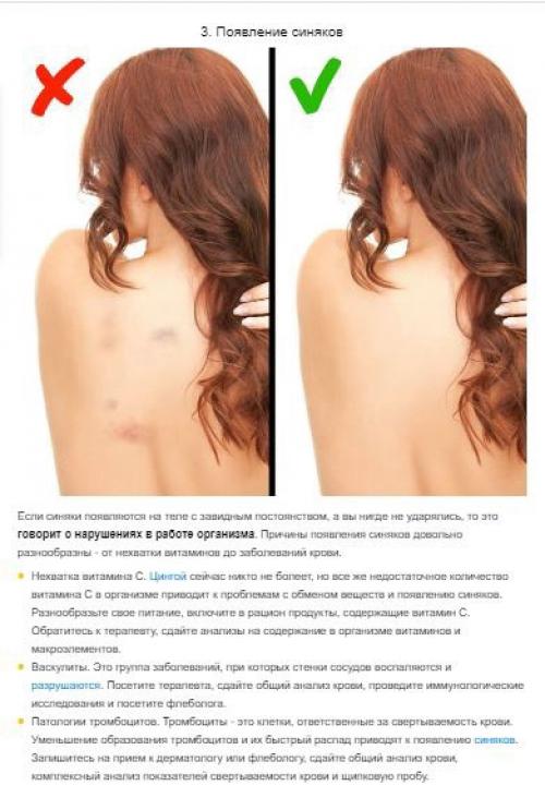 7 сигналов организма, которые не стоит игнорировать, чтобы сохранить здоровье. 04