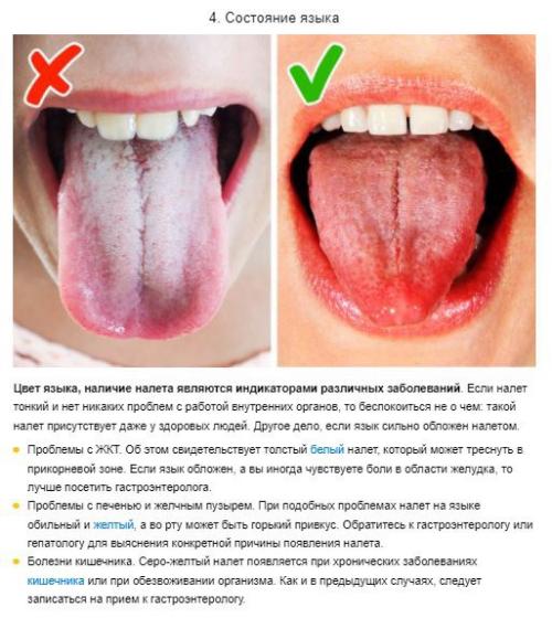 7 сигналов организма, которые не стоит игнорировать, чтобы сохранить здоровье. 03
